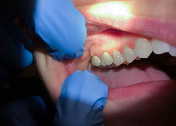 Best After-Hours Emergency Dentist in Bourg, LA