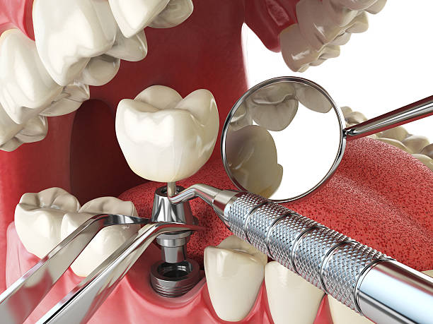 Best Pediatric Emergency Dentist in Bourg, LA